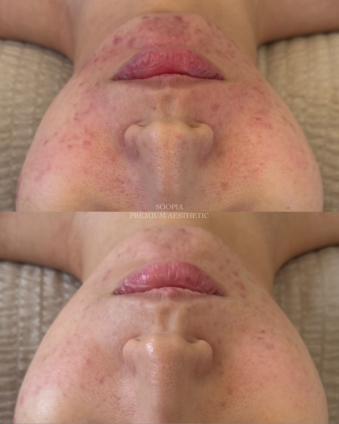 수피아 리뷰 이미지 2