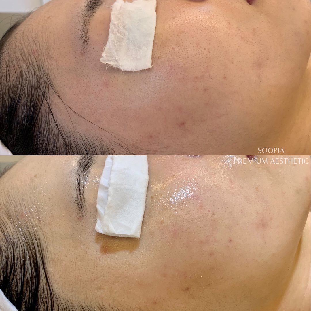 수피아 리뷰 이미지 3